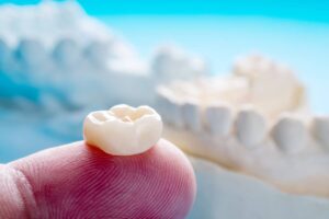 featured image for article about do dental crowns look natural